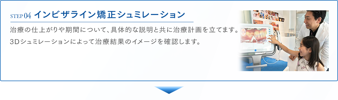 STEP04 インビザライン矯正シュミレーション 治療の仕上がりや期間について、具体的な説明と共に治療計画を立てます。3Dシュミレーションによって治療結果のイメージを確認します。