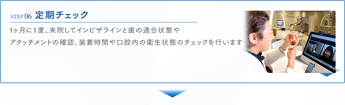 STEP06 定期チェック 1ヶ月に1度、来院してインビザラインと歯の適合状態やアタッチメントの確認、装着時間や口腔内の衛生状態のチェックを行います。