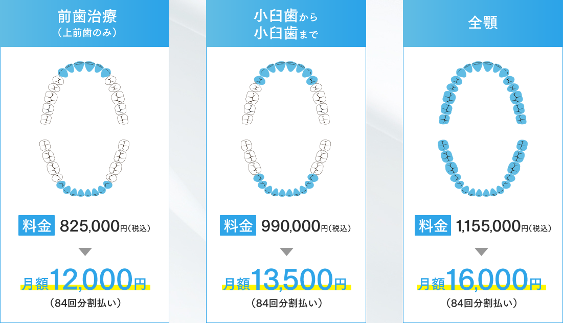 前歯治療（上前歯のみ）月額12,000円（84回分割払い）