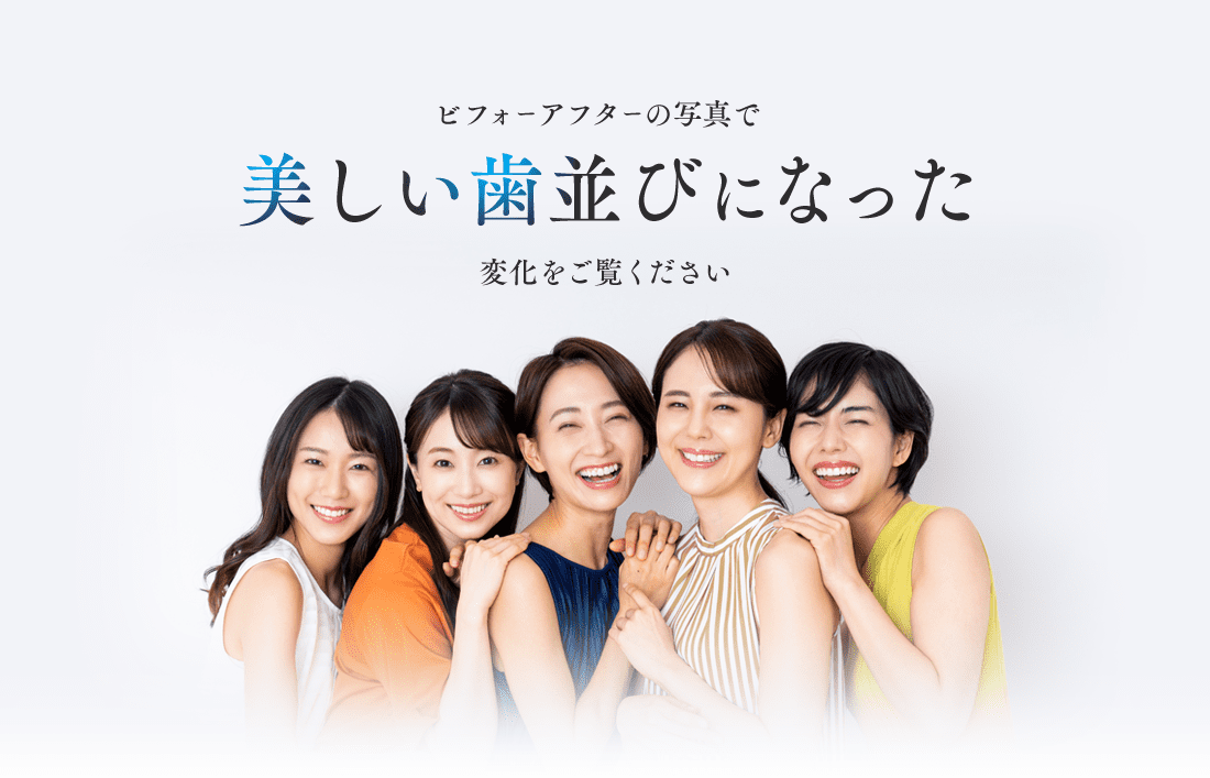 ビフォーアフターの写真で美しい歯並びになった変化をご覧ください