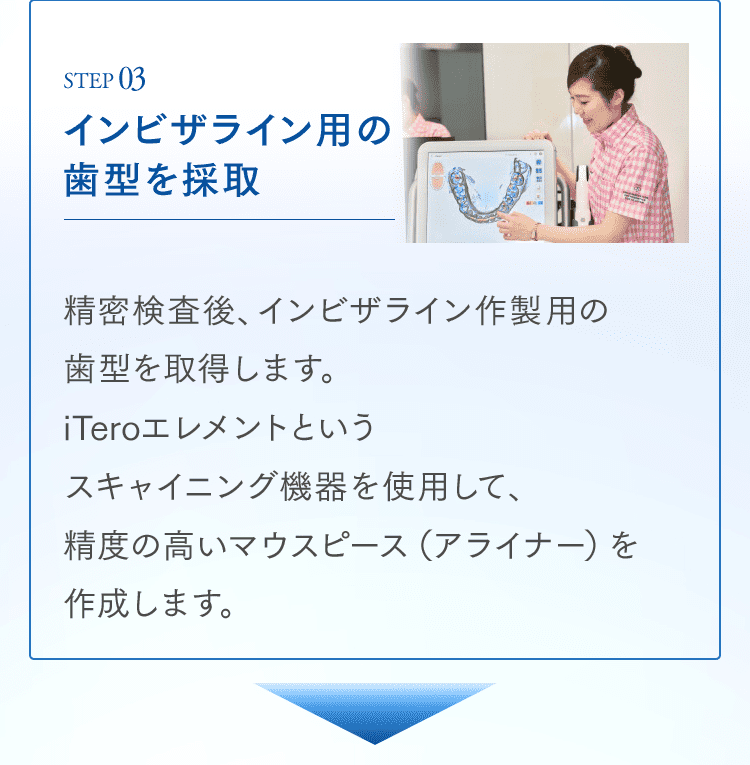 STEP03 インビザライン用の歯型を採取 精密検査後、インビザライン作製用の歯型を取得します。iTeroエレメントというスキャイニング機器を使用して、精度の高いマウスピース（アライナー）を作成します。