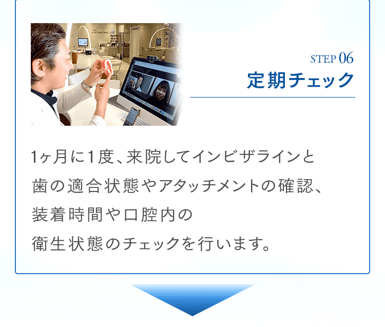 STEP06 定期チェック 1ヶ月に1度、来院してインビザラインと歯の適合状態やアタッチメントの確認、装着時間や口腔内の衛生状態のチェックを行います。