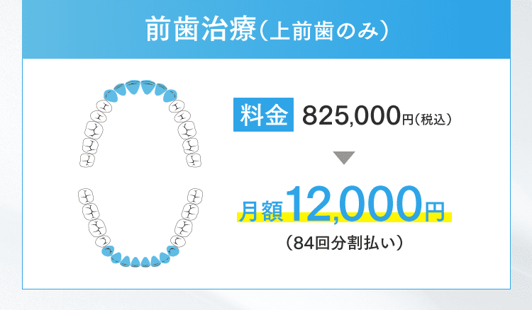 前歯治療（上前歯のみ）月額12,000円（84回分割払い）