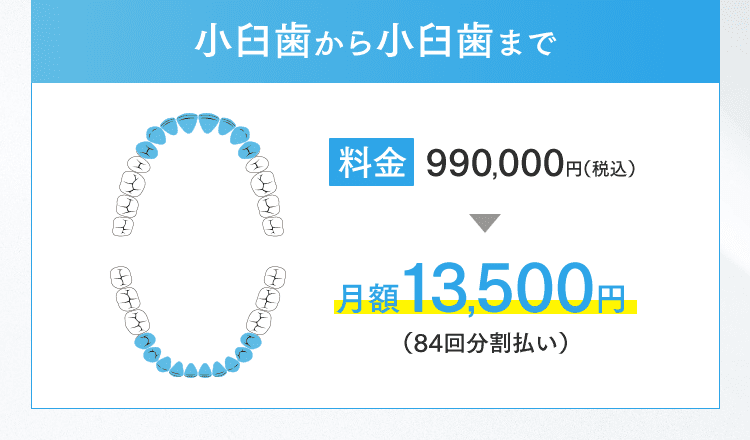 小臼歯から小臼歯まで 月額13,500円（84回分割払い）