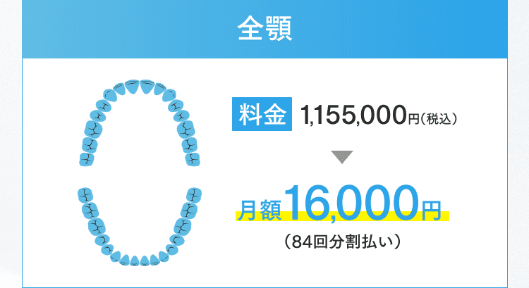 全顎 月額16,000円（84回分割払い）