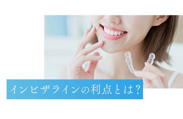 インビザラインの利点とは？