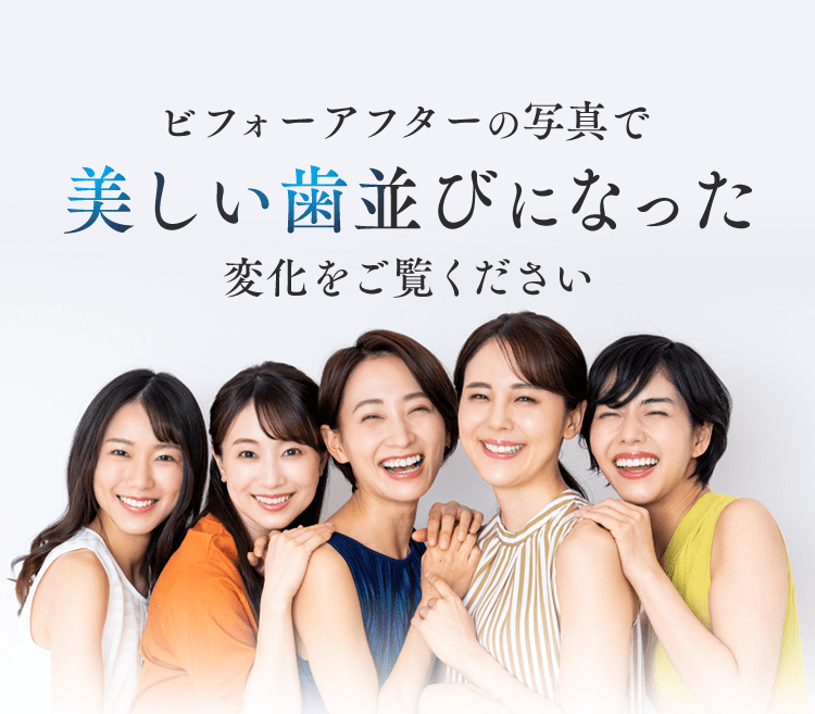 ビフォーアフターの写真で美しい歯並びになった変化をご覧ください