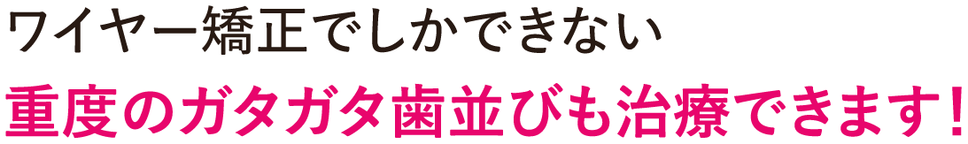 ワイヤー矯正でしかできない重度のガタガタ歯並びも治療できます！