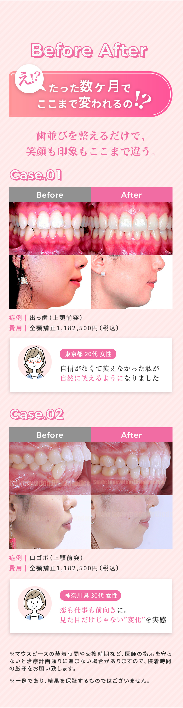 Before After
