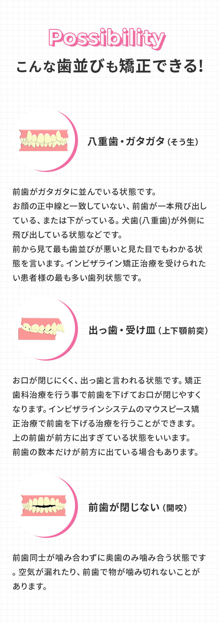 こんな歯並びも矯正できる!